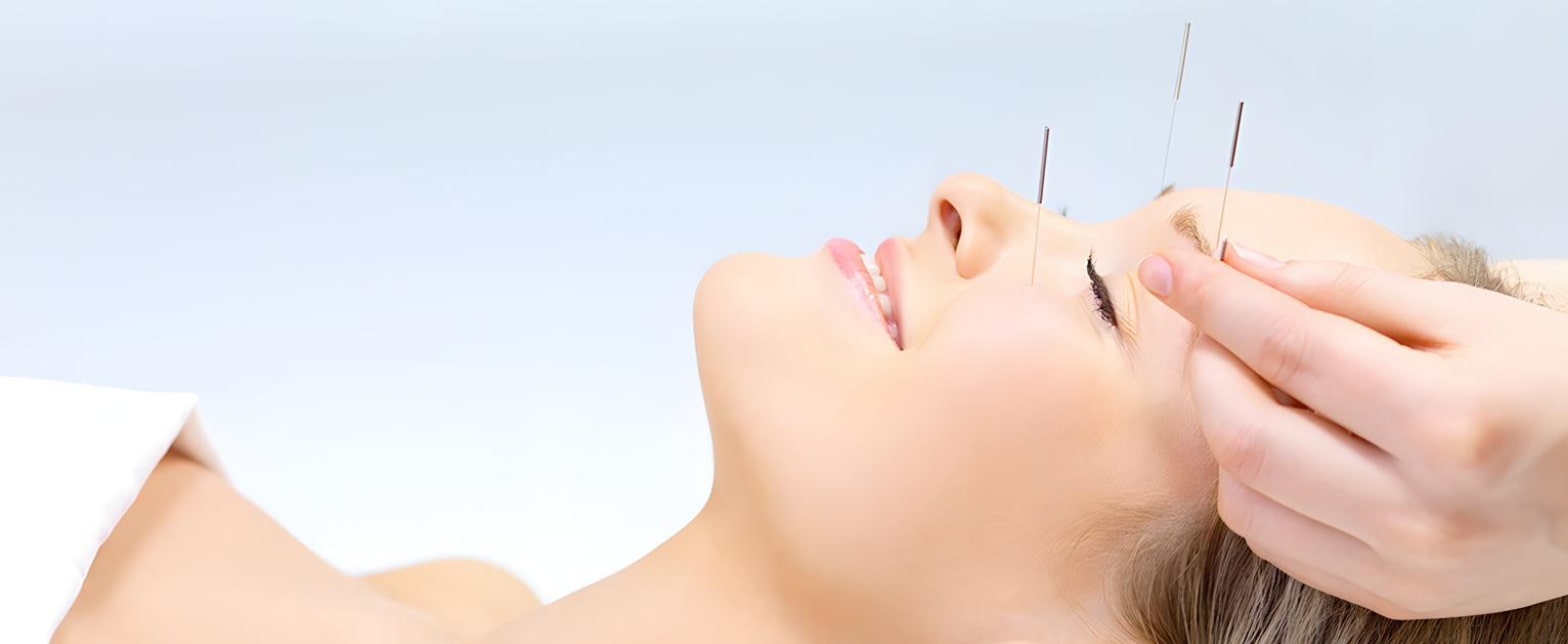 Patient receiving facial acupuncture treatment